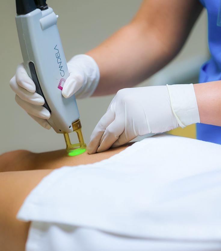 Depilação a Laser