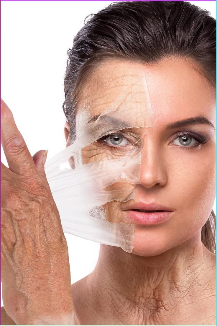 Peeling